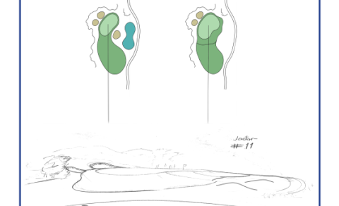 Breytingar á 11. braut Jaðarsvallar 2024